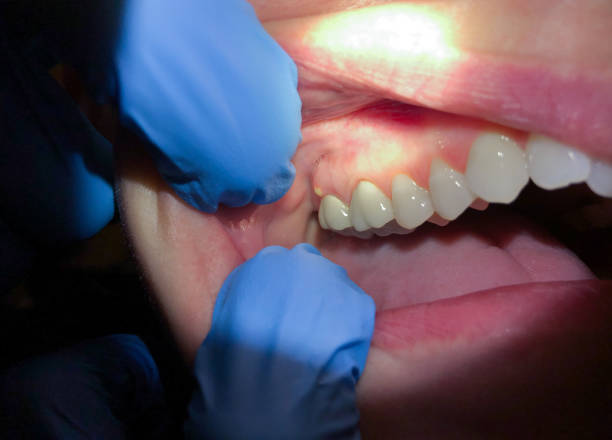 Best Teeth Whitening  in Rockville, IN