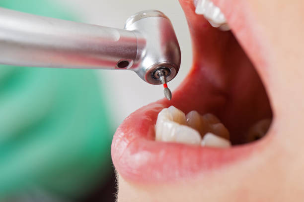 Best Emergency Pediatric Dentist  in Rockville, IN